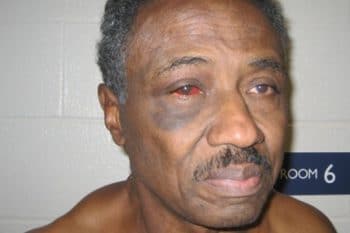| Herman Bell after beat down | MR Online