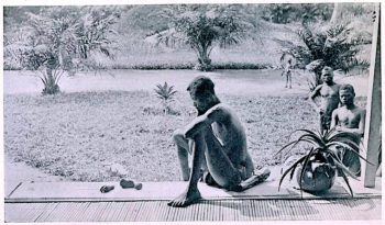 | Father stares at the hand and foot of his five year old daughter which were severed as a punishment for having harvested too little caoutchoucrubber Photo taken at Baringa Congo state May 15 1904 | MR Online