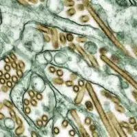 A microscopic photo of H5N1 Bird Flu virus (gold). [Photo: Centers for Disease Control and Prevention]