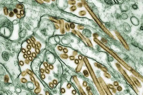 | A microscopic photo of H5N1 Bird Flu virus gold Photo Centers for Disease Control and Prevention | MR Online